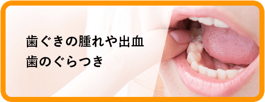 歯ぐきの腫れや出血歯のぐらつき
