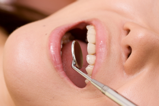 口腔内のチェックを受ける様子