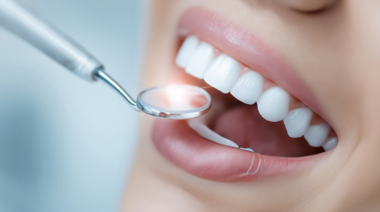 ホワイトニングを受け白く美しい歯になった女性