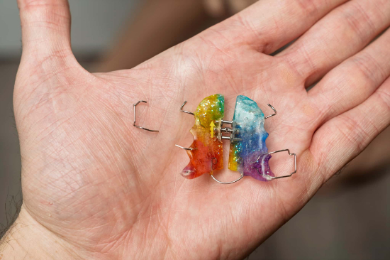 手の平にのせた破損した床矯正の装置