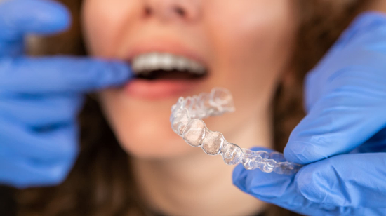 マウスピース矯正中に口内炎ができて歯科医に診察してもらう患者