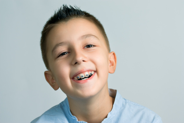 すきっ歯をワイヤー矯正で治療する子供